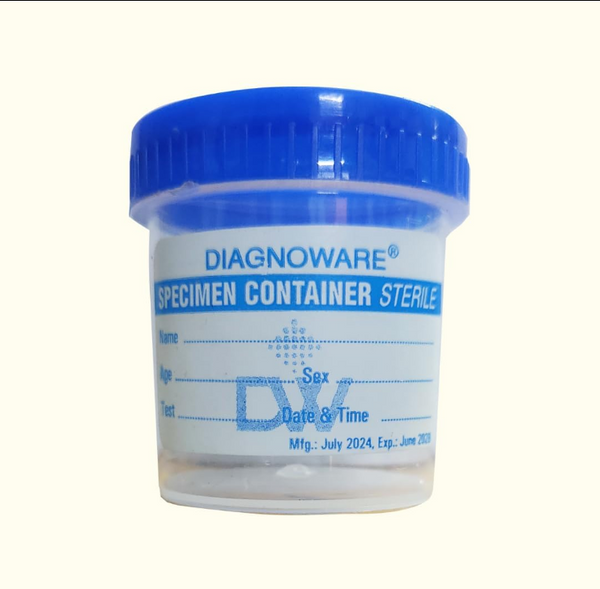 Urine Sample Bottles 30ml for Safe Collection & Storage