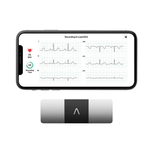 Six-Lead Portable ECG Device – Fast, Accurate, & Safer Alternate to 12-Lead ECG Machine | US FDA Cleared & Clinically Validated Device | Record ECG at Home Safely