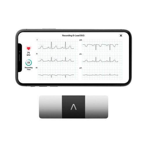 Six-Lead Portable ECG Device – Fast, Accurate, & Safer Alternate to 12-Lead ECG Machine | US FDA Cleared & Clinically Validated Device | Record ECG at Home Safely