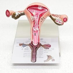 Uterus Ovary Model Body Anatomy Replica of Female Reproductive System Organ Anatomical Model with base  showing the common Pathologies for Doctors Office Educational Tool