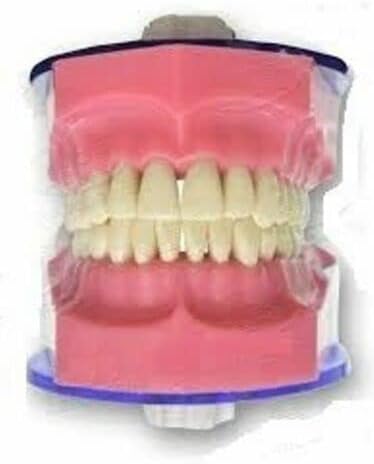 Spancare Jaw Set and Teeth B 561 Easily Fitted in The Phantom