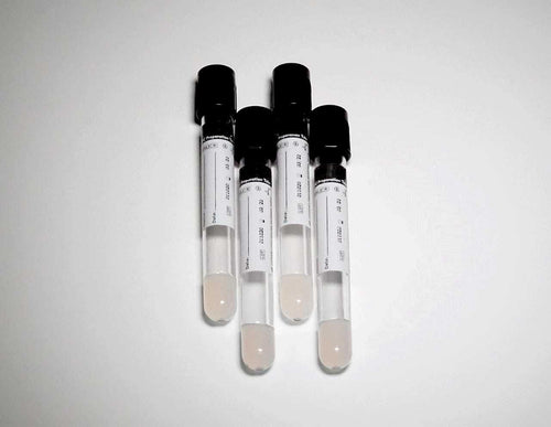 Spancare Autologus Conditioned GFC Preparation Tube for Hair Draw Volume 6 mL 2 Box