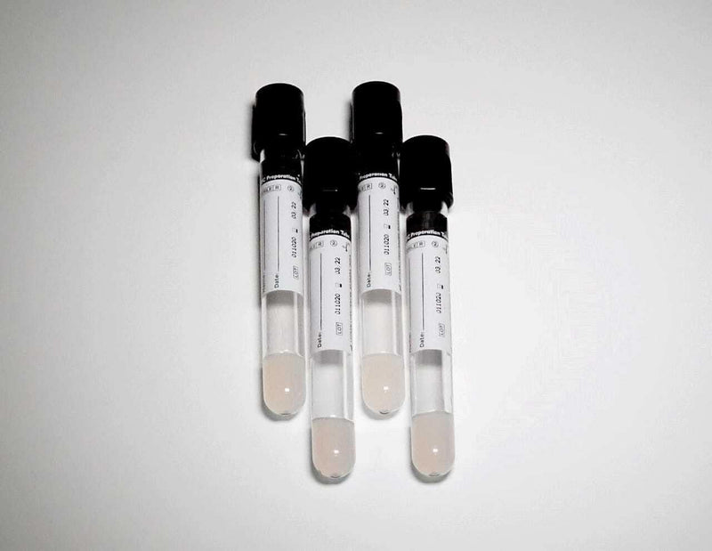 Spancare Autologus Conditioned GFC Preparation Tube for Hair Draw Volume 6 mL 2 Box