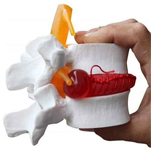 Spancare Human Lumbar Demonstration Model with Herniating Disc, Varied Textures