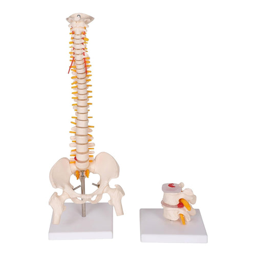 Mini Spine Model with VERTEBRAE Degeneration Model (Educational Model)