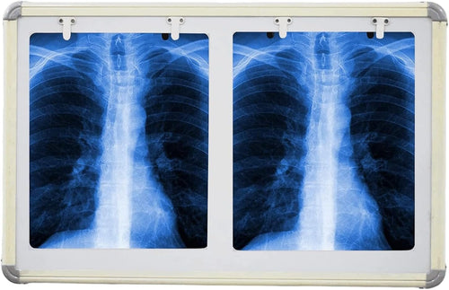 LED X-Ray View Box, Double Film, 28 x 17 Inch, Automatic Film Activation, Variable Brightness Control