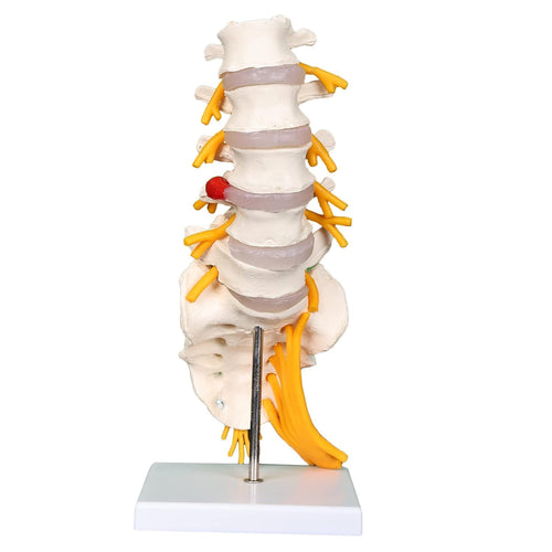 Lumbar Sacrum Spine Model (ORTHOPADIC Model)
