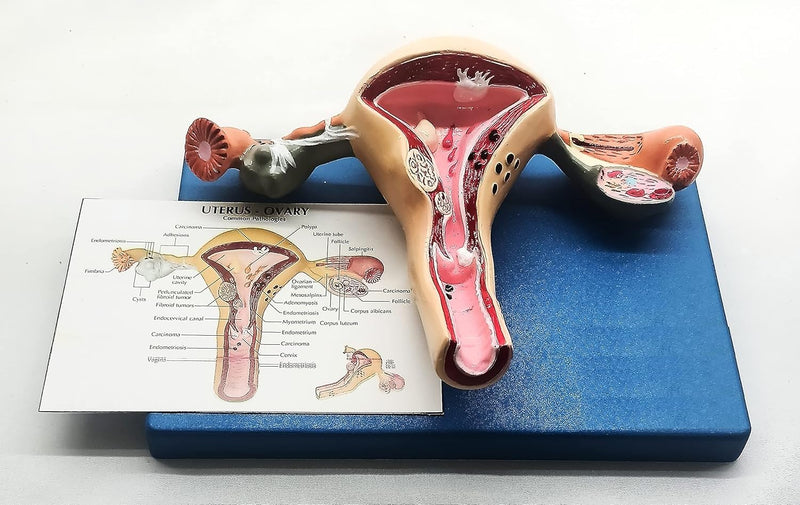 SPANCARE PHARMACEUTICALS Uterus and Ovary Model Female Reproductive Organ Model Human Anatomy Replica Showing Teaching Anatomical Gynecology Doctor Patient Communication Simulation